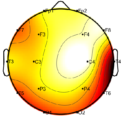 R08_S8_W6_S.png