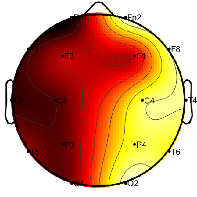 R11_S7_W59_F.png