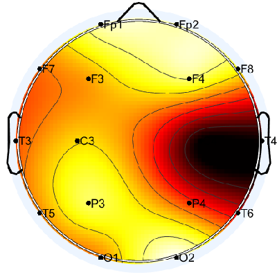 N04_S1_W36_F.png