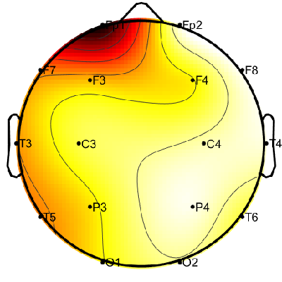 R12_S1_W32_S.png