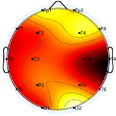 N04_S8_W2_F.png