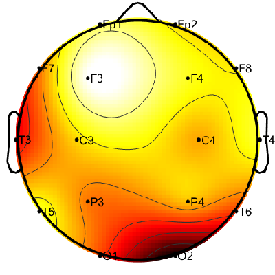 R15_S1_W46_F.png