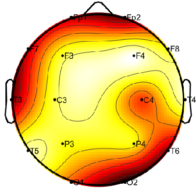 R15_S2_W34_F.png