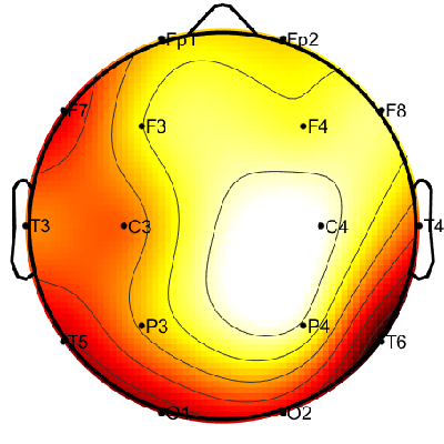 R08_S6_W44_S.png
