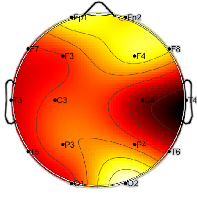 N04_S8_W2_F.png