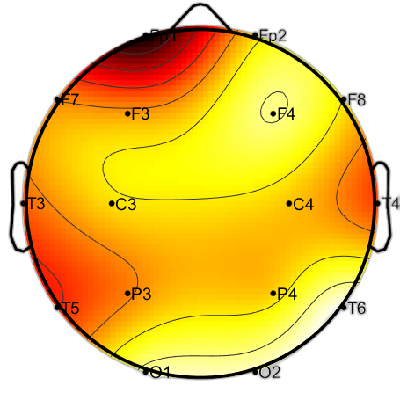R12_S5_W60_S.png