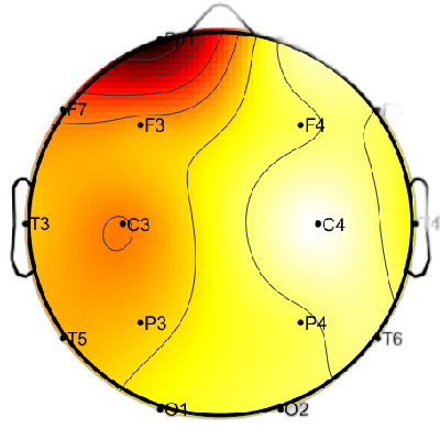 R12_S7_W5_S.png