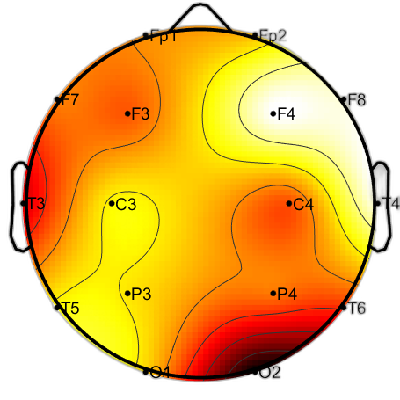 R15_S6_W31_S.png