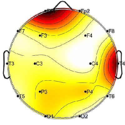 N06_S5_W24_F.png