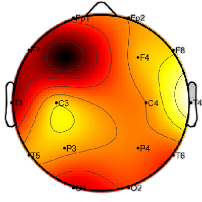 R15_S5_W2_F.png