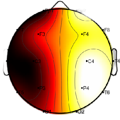 R11_S8_W18_F.png