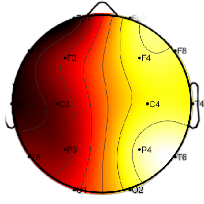 R11_S7_W45_F.png