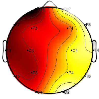 R11_S7_W18_F.png