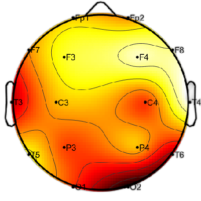R15_S2_W36_S.png