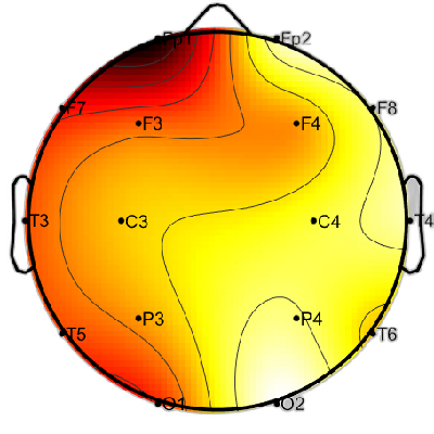 R12_S1_W8_S.png
