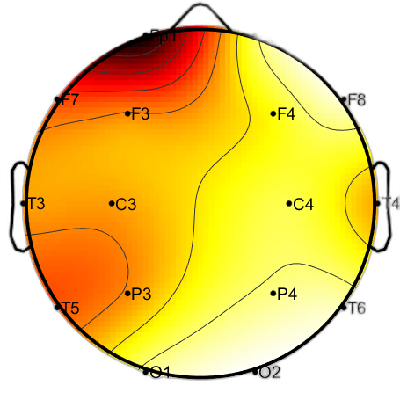 R12_S1_W11_S.png