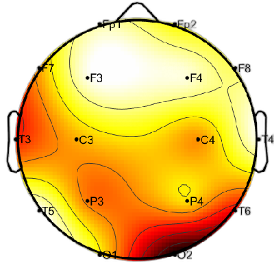 R15_S1_W60_S.png