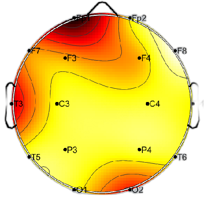 N01_S2_W48_F.png