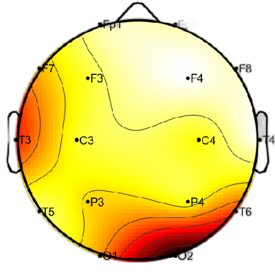 R15_S2_W16_S.png