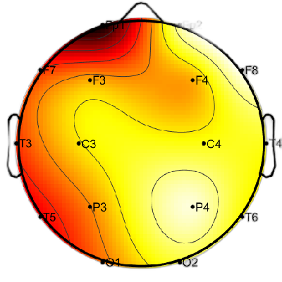 R12_S1_W15_S.png