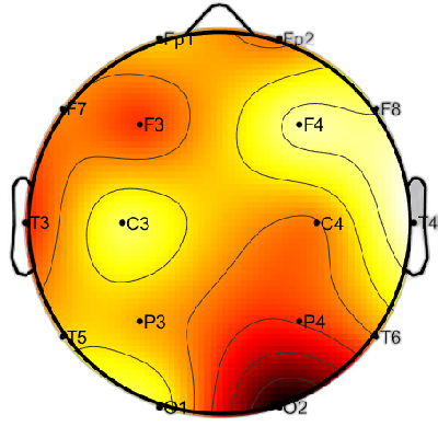 R15_S1_W3_F.png