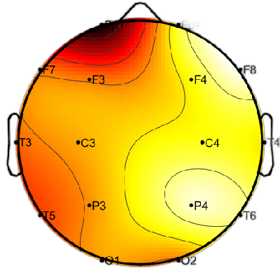 R12_S5_W17_S.png