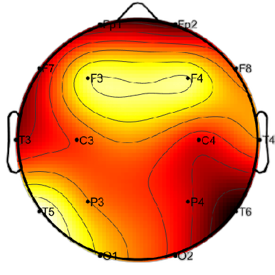 R15_S5_W50_F.png