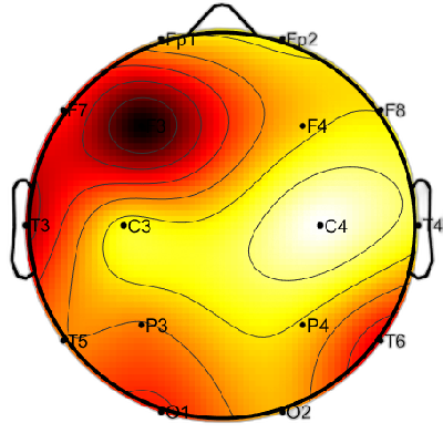 R15_S6_W38_F.png