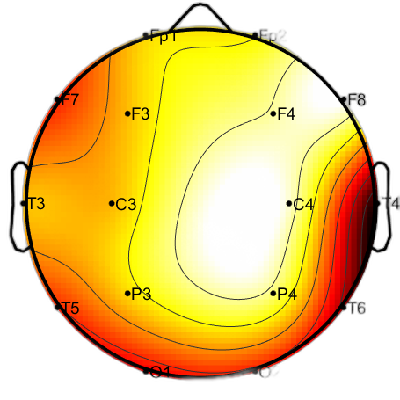 R08_S8_W28_S.png