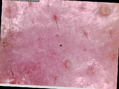 augCombi_13.jpg