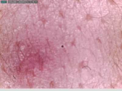 augCombi_14.jpg