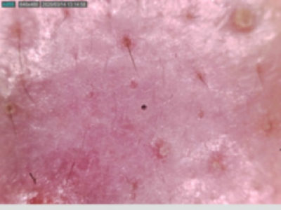 augCombi_16.jpg