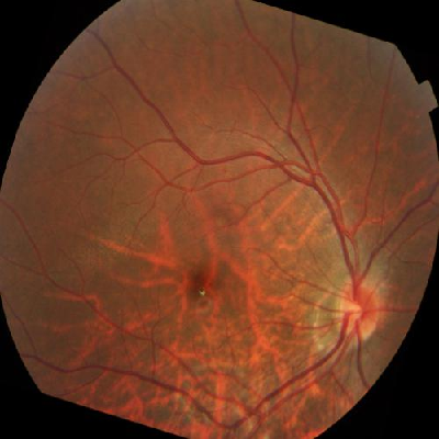 augmented_image_612.jpg