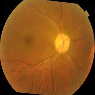 augmented_image_358.jpg