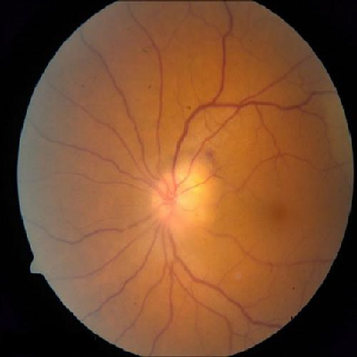 augmented_image_475.jpg