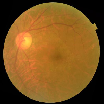 augmented_image_601.jpg