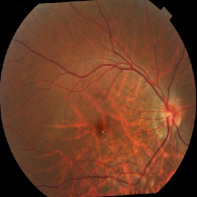 augmented_image_563.jpg