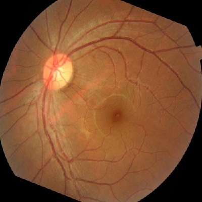 augmented_image_500.jpg
