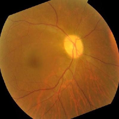 augmented_image_605.jpg