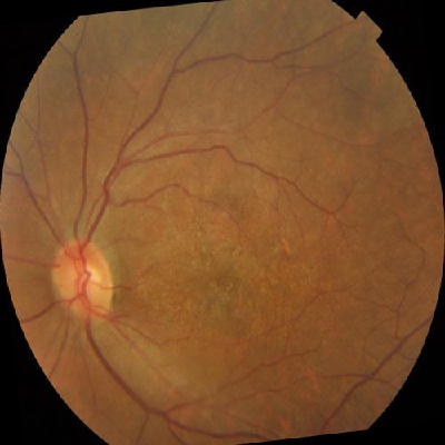 augmented_image_105.jpg