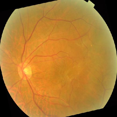 augmented_image_383.jpg