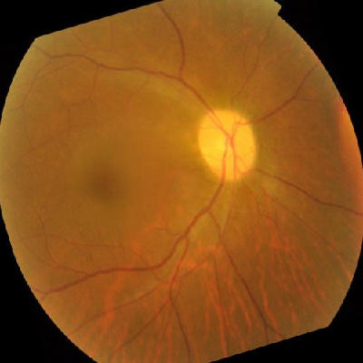 augmented_image_357.jpg