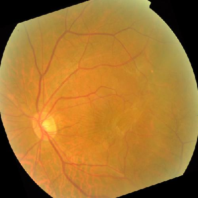 augmented_image_384.jpg