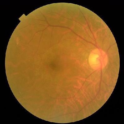 augmented_image_506.jpg