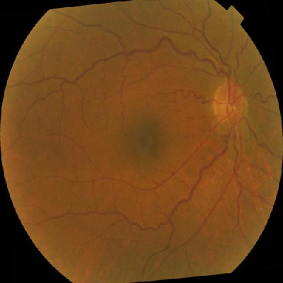 augmented_image_140.jpg