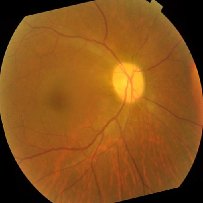 augmented_image_548.jpg
