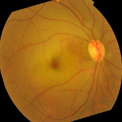 augmented_image_462.jpg