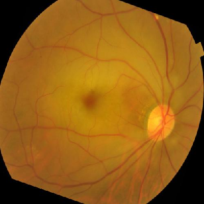 augmented_image_591.jpg