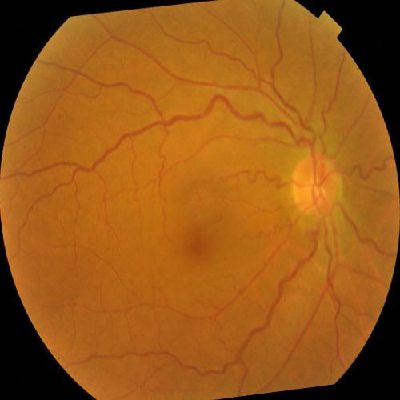 augmented_image_112.jpg