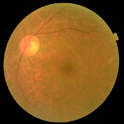 augmented_image_377.jpg